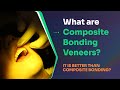 What are composite bonding veneers? Is it better than composite bonding?