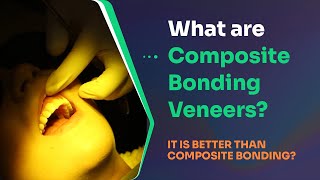 What are composite bonding veneers? Is it better than composite bonding?