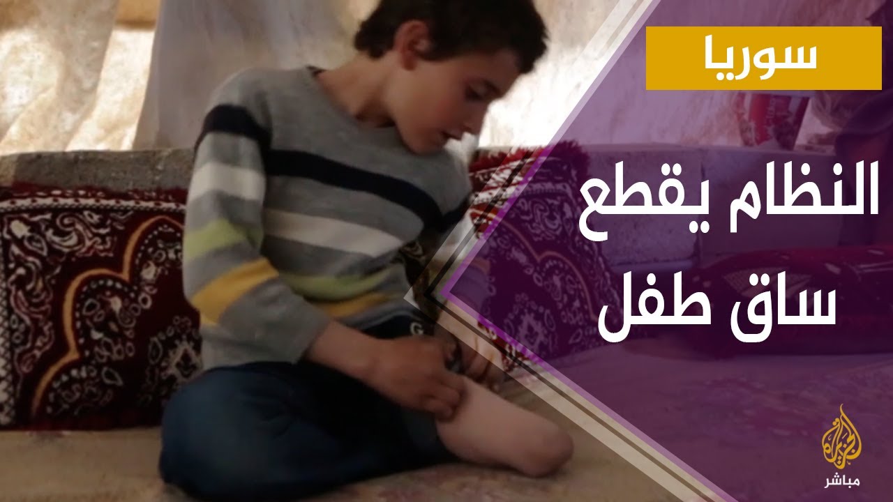 قوات النظام السوري تقطع ساق طفل سوري أثناء لعبه أمام منزله