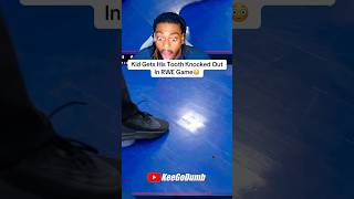 Kid Gets His Tooth Knocked Out In RWE Game #shorts #camwilder #rwe #tiktok #reels #shortvideo #fyp