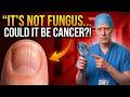 7 Signs of Deadly Disease You Keep Ignoring LOOK AT YOUR NAILS RIGHT NOW!