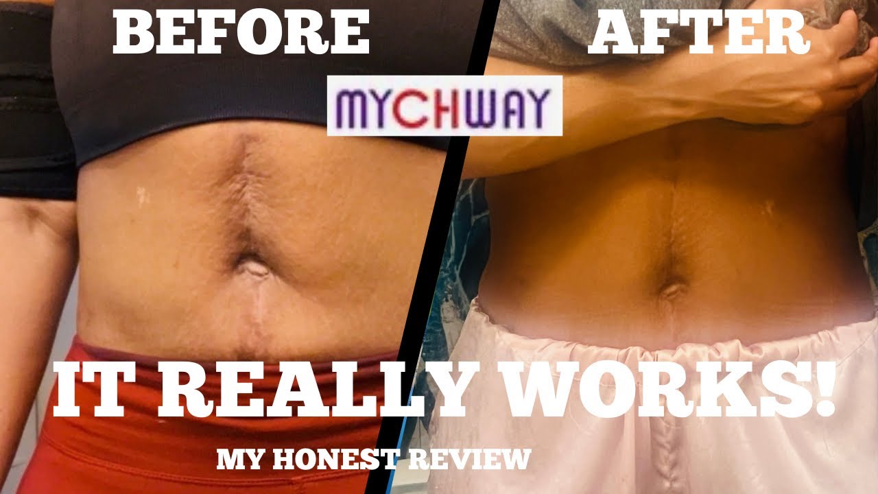 Честный отзыв о домашнем аппарате для кавитационной коррекции фигуры MYCHWAY #mychway