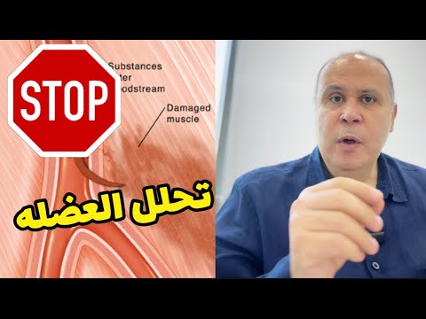 وقف دواء الكوليسترول فورا في هذه الحاله