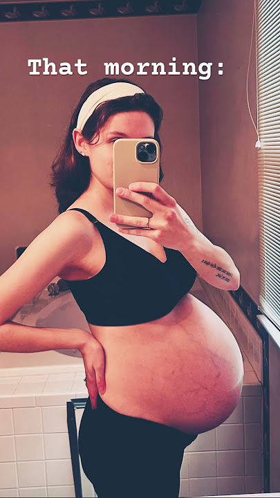 Unexpected Twin Birth at 35 weeks