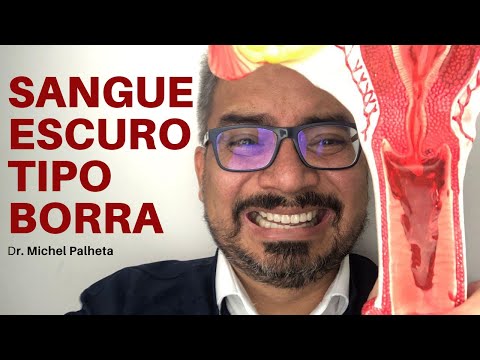 MENSTRUAÇÃO ESCURA TIPO BORRA DE CAFÉ