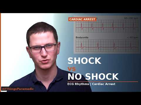 Shockable vs Non-Shockable ECG Rhythms: Paramedic Guide to Cardiac Arrest