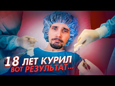 Видео: 18 ЛЕТ КУРИЛ - ВОТ РЕЗУЛЬТАТ...