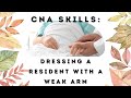 Dress a resident with a weak arm cna skill prometric