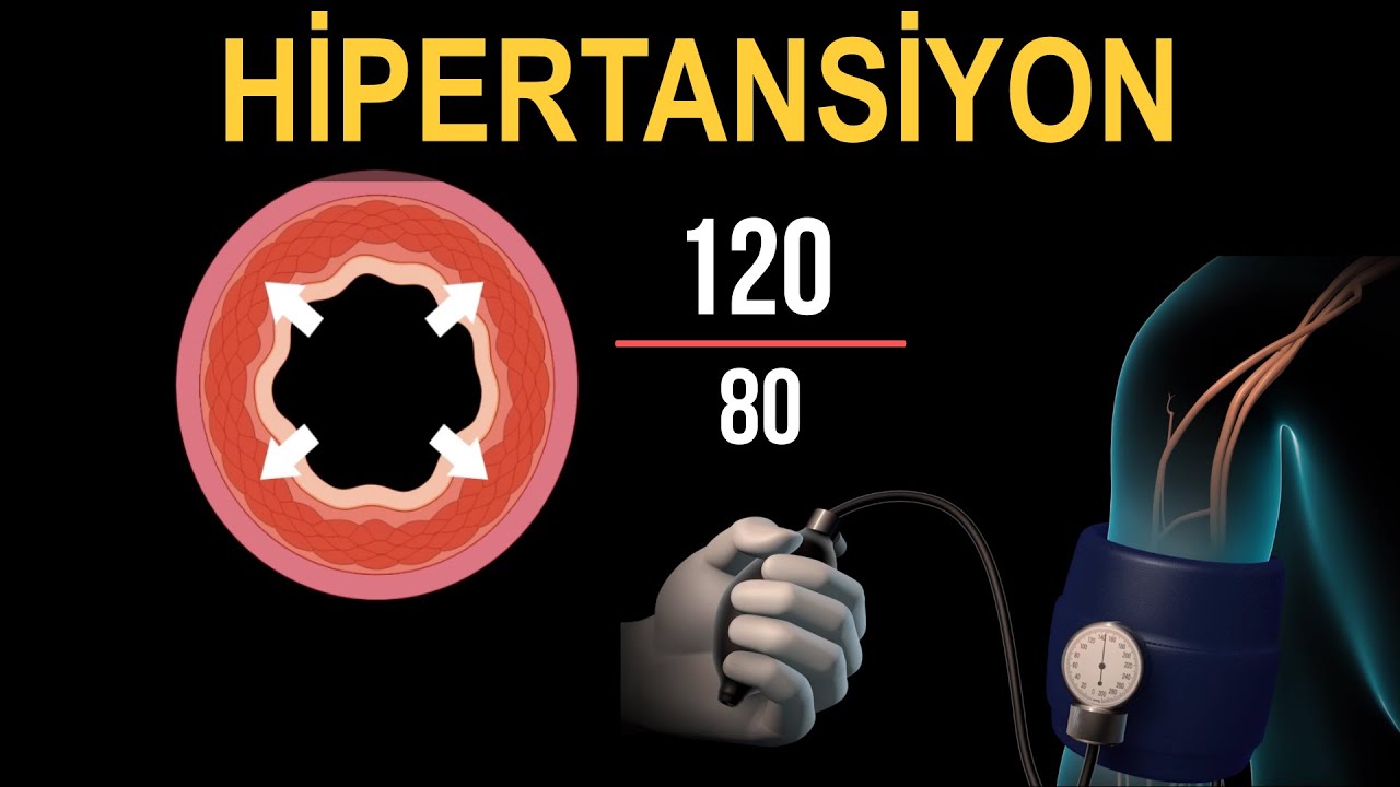 Hypertension