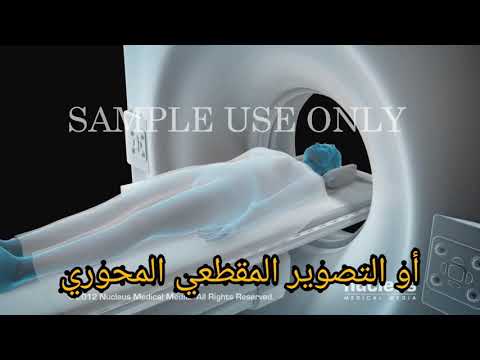 التصوير الطبقي المحوري  