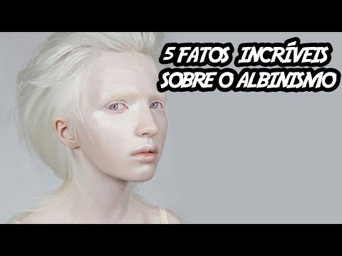 Vídeo: O Significado Do Nome Albina
