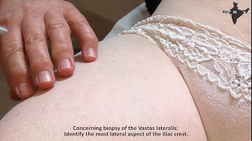 Conchotome Muscle Biopsy