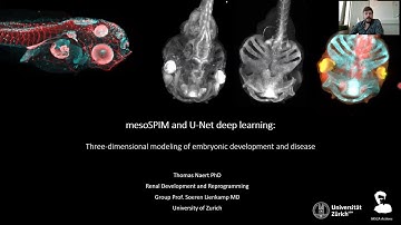 Thomas Naert: mesoSPIM and U-Net deep learning: three-dimensional modeling of embryonic development