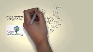 Needle FREE Allergy Skin Tests for Dog, Cat, Pollen, Dustmites, Peanut Allergy, Milk-Shellfish-Nuts