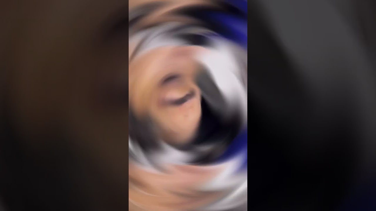 Eyebrows Microblading done by our experts at Dermalyn Aesthetics | Dr. Muskan Tyagi |