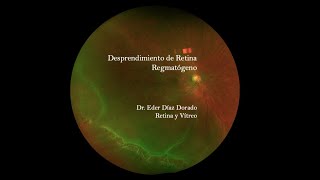 Eder Díaz Dorado-7