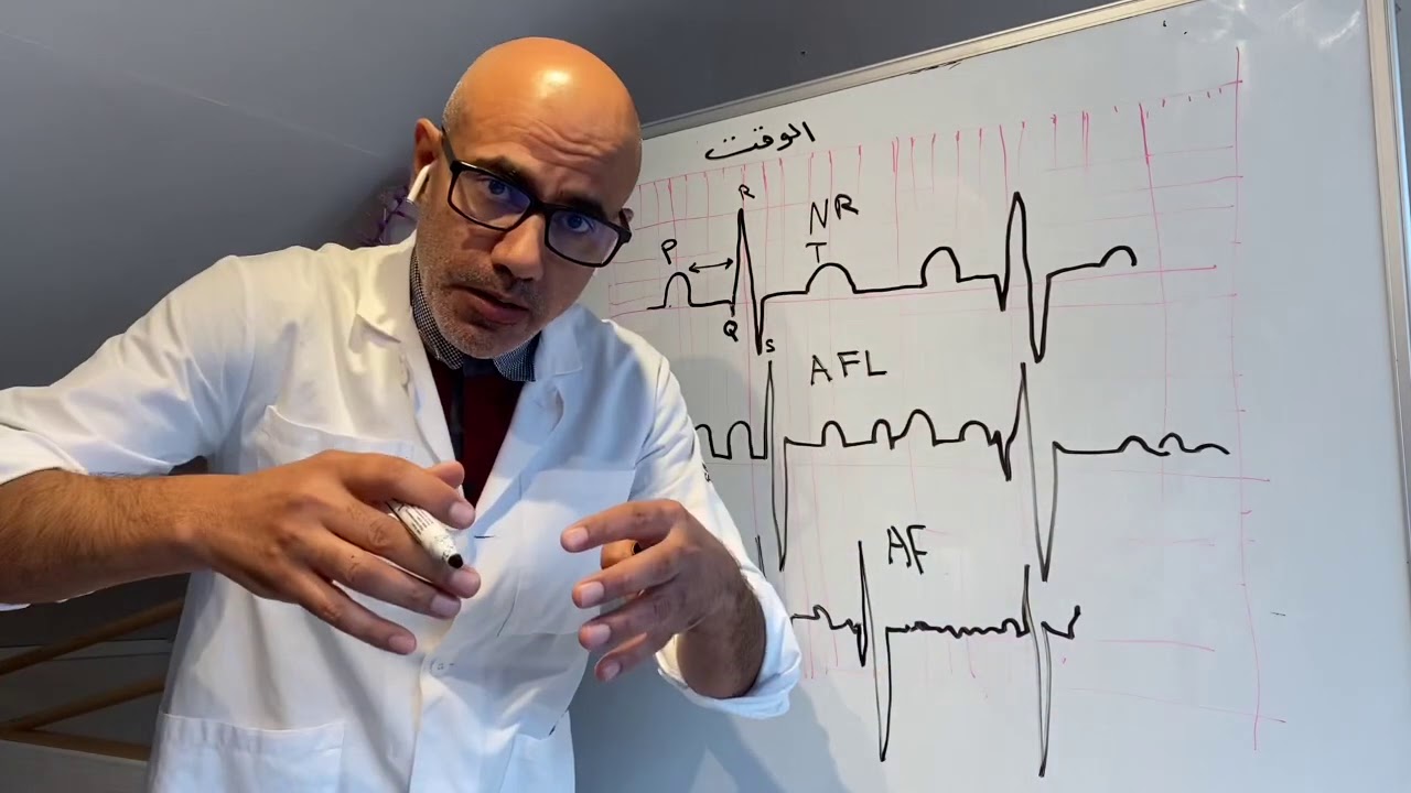 ٢-اعلمك كيف تقرأ تخطيط القلب الكهربائي ECG الارتجاف الاذيني انته تشخصه  #وليد_سرحان#الدورة_السويدية