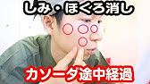 ひまし油 重曹で手作りカソーダ使用上の注意 カソーダでシミやイボが取れる Youtube