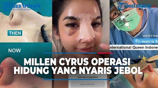 Hidung Permak Millen Cyrus Nyaris Jebol, Ponakan Ashanty Oplas Lagi, Hasilnya Tuai Pujian