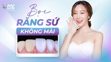 Kỹ thuật bọc răng sứ không mài