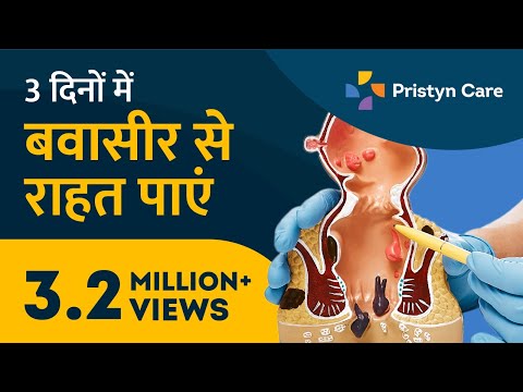 वीडियो: पाल्मर मौसा के इलाज के 3 तरीके