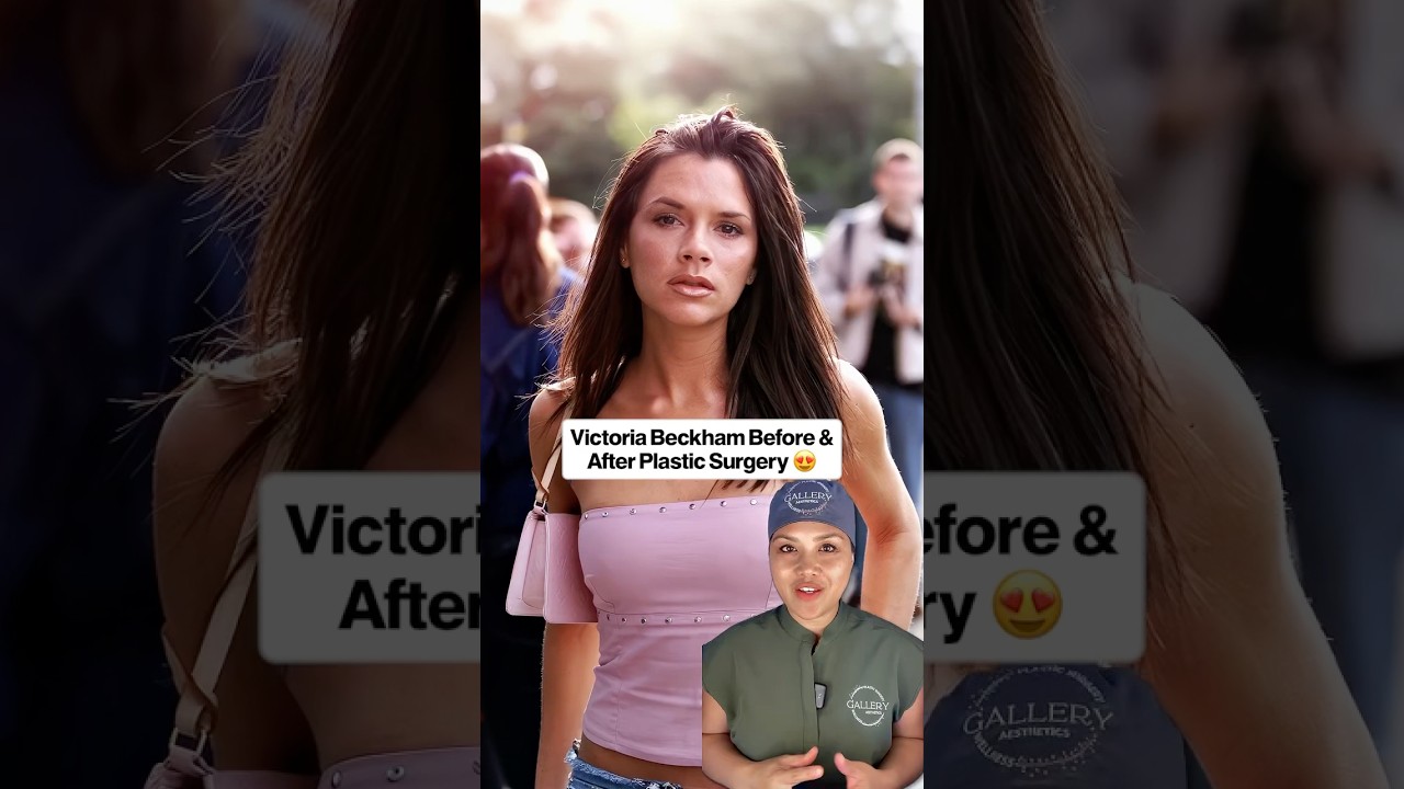 Victoria Beckham before and after plastic surgery. #victoriabeckham  #spicegirl  #plasticsurgeon