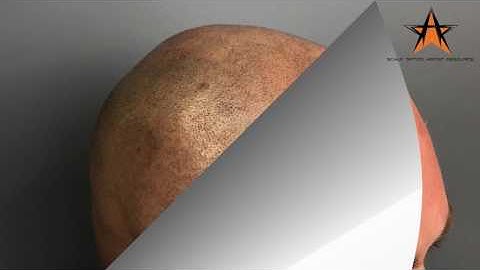 S.T.A.R. Client Before and After