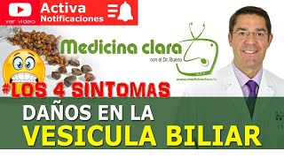 ‍⚕ LOS 4 SINTOMAS ALARMA *VESÍCULA BILIAR DAÑADA* PIEDRAS | Medicina Clara