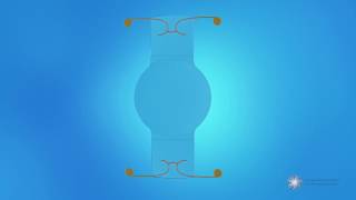 What is an accommodative intraocular lens (IOL)?