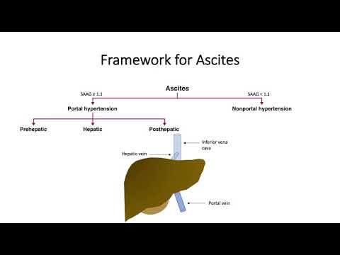 Differential Diagnosis of Ascites