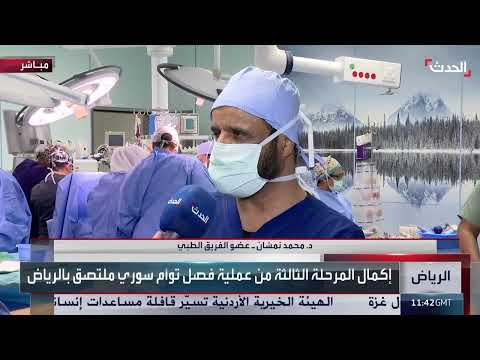 نجاح عملية فصل التوأم اليمني إيلين وسيلين