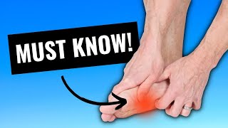Plantar Fasciitis, 4 Things You Must Do To Stop The Pain!