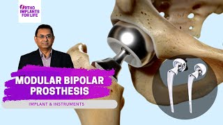 Modular Bipolar Prosthesis | Implants & Instruments