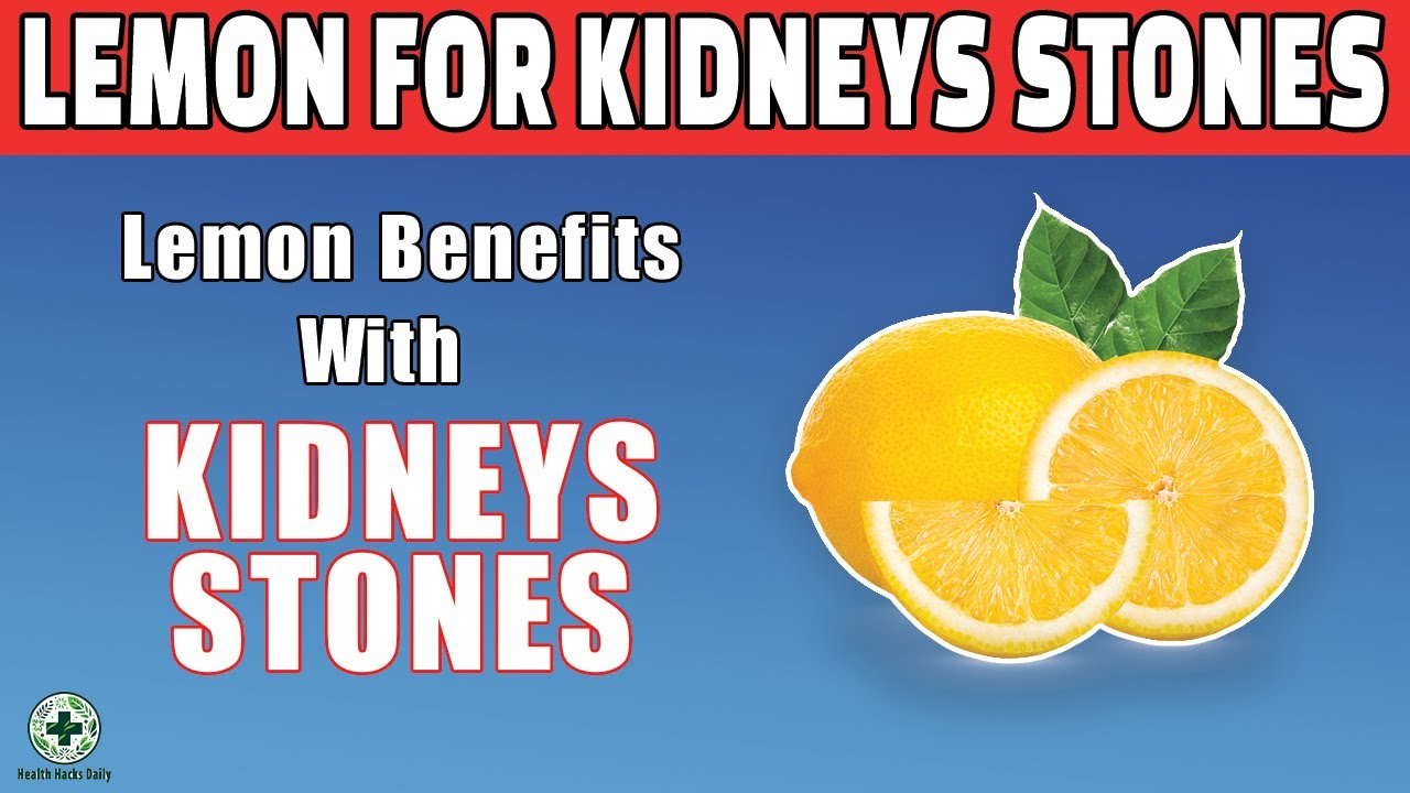 Eliminate Kidney Stones With Lemons Kidney Stone Causes & Lemon Benefits Health Hacks Daily
