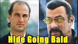 Top 20 Celebrities Who Tried to Hide Going Bald