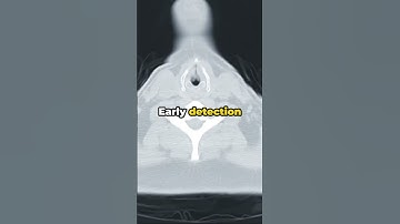 The Shocking A.I. Predictions That