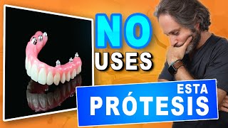 Prótesis    Ventajas y Desventajas.Prótesis Dental Fija que  RECOMIENDO ⛔