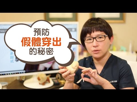 如何預防假體穿出！