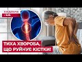 ВИ НАВІТЬ НЕ ЗДОГАДУЄТЕСЬ, ЩО МАЄТЕ ОСТЕОПОРОЗ! Як ВЧАСНО виявити проблему? Лікар пояснила!
