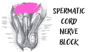 Spermatic Cord Nerve Block
