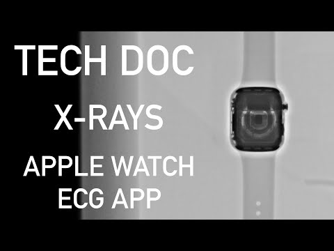 tech-doc-reviews-apple-watch-ecg-app:-can-apple-a-day-really-keep-the-doctor-away?