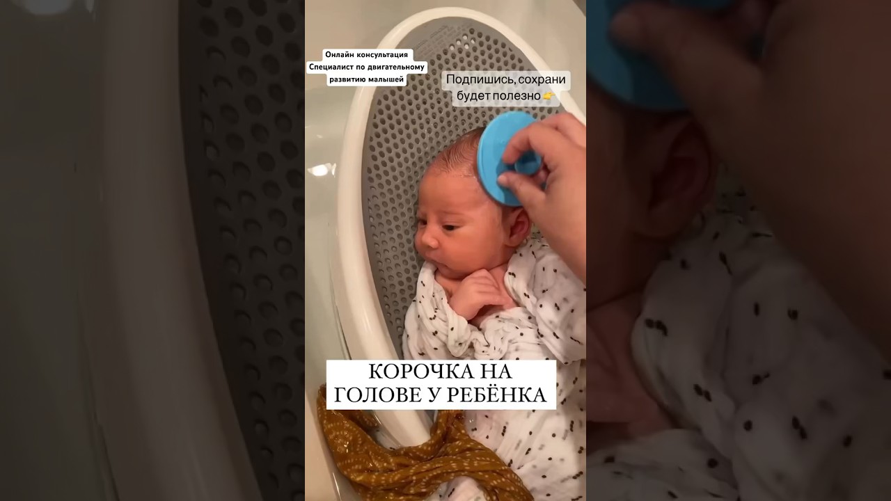 КОРОЧКИ НА ГОЛОВЕ У МАЛЫША #онлайнконсультации #малыш #груднички #занятиесдетьми