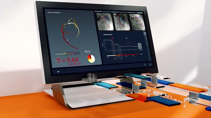 Physiology Redefined - Learn About the New Era in Physiology with the CathWorks FFRangio System