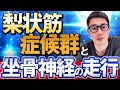 【走行ルートの理解で神経障害の見逃しを防ぐ‼︎】梨状筋症候群と坐骨神経の関係を整理して痛みのメカニズムを明確化しよう