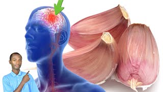 Tungurusumu3 Inshuro3 Mucyumweru Bihagarika Indwara Zubwonko?