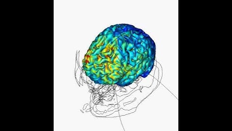 Cortical Modulation using tDCS - High-Resolution Computational Model of tDCS