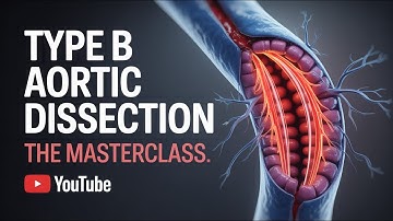 Type B Aortic Dissection Masterclass: dP/dt Control, TEVAR Strategy, and False Lumen Risk Explained