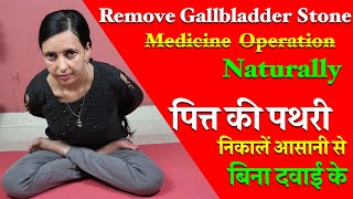 Gallbladder Stones - Remove Naturally l Gallstones l Gallbladder Pain l Healthcity screenshot 2