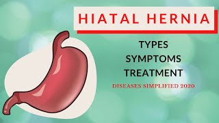 Hiatal Hernia: Types, Symptoms & Treatment