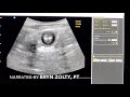 Ultrasound imaging for constipation | Connect PT